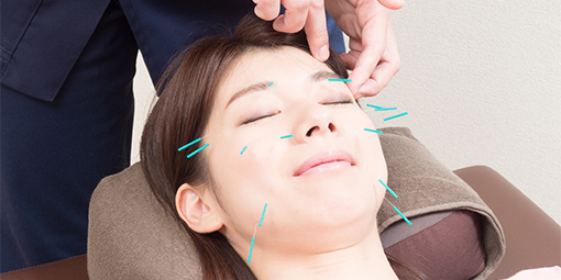 美容鍼
